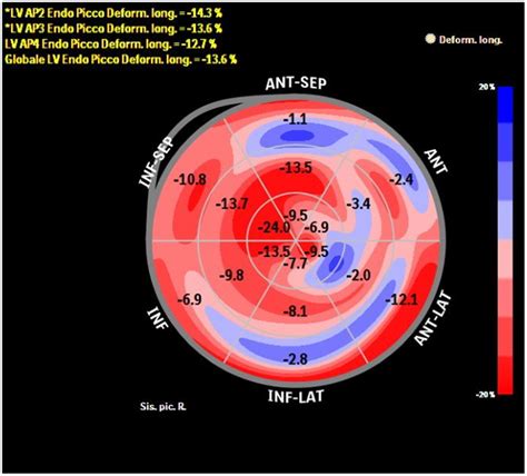 lv bullseye|bull's eye tracking video.